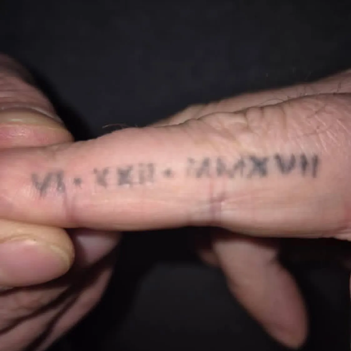 Tattoo on finger before laser removal treatment